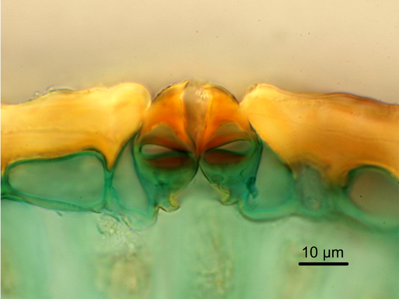 Ulex europaeus, histologie #18600