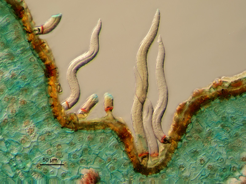Ulex europaeus, histologie #18599