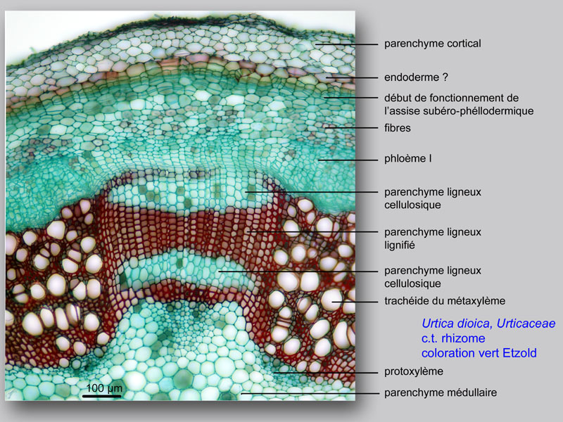 Urtica dioica, histologie, histology. #23859