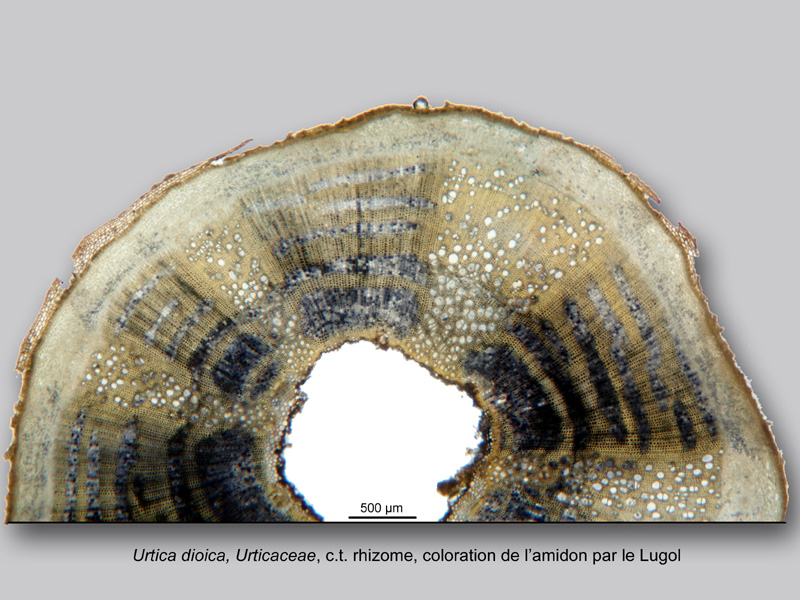 Urtica dioica, histologie, histology. #23864
