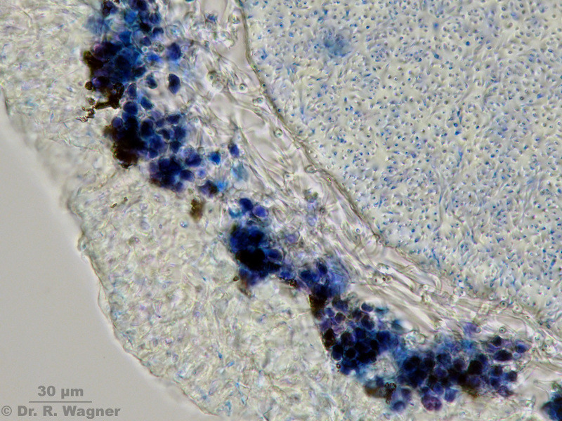 Usnea fulvoreagens #15347
