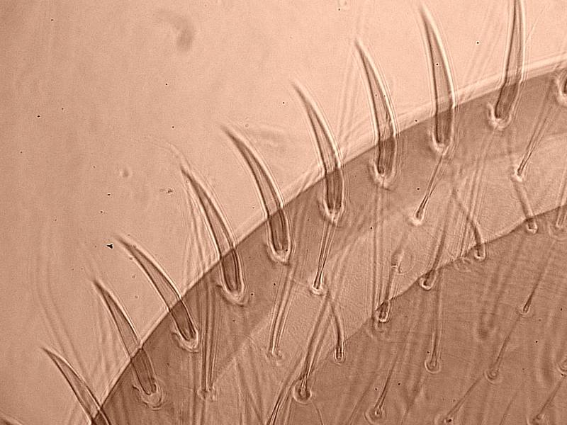Varroa cf destructor - Acarien #17345
