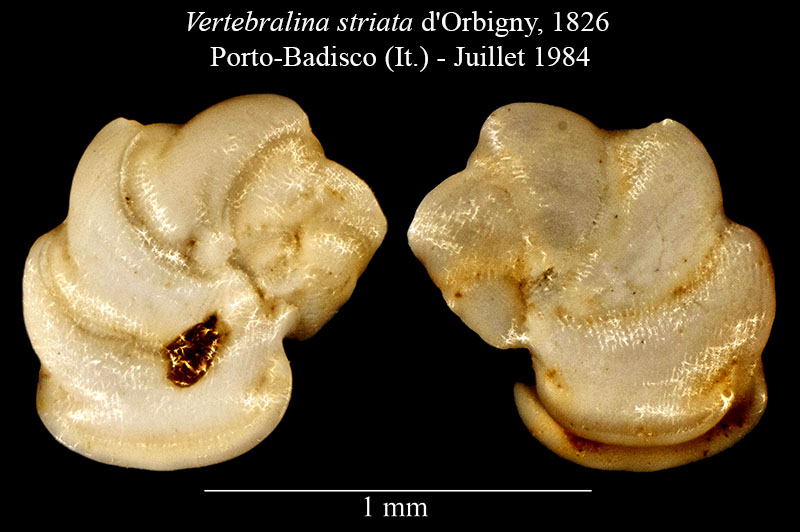 Vertebralina striata #56485