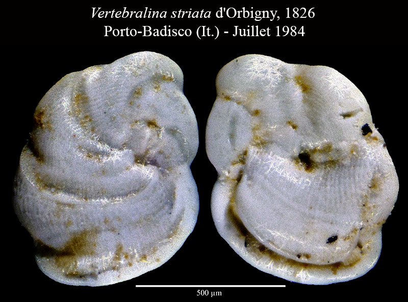 Vertebralina striata #56484