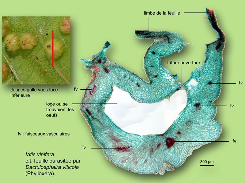Vitis, Phylloxera, histologie, histology. #23975