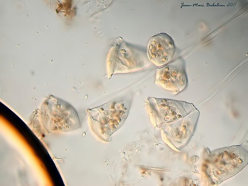 Vorticella sp #25746