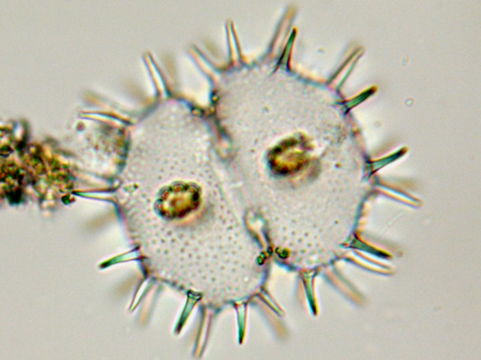 Xanthidium basidentatum #75221