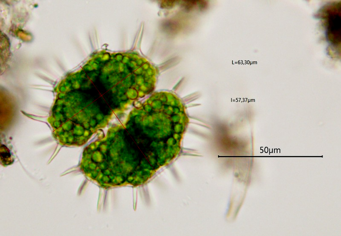 Xanthidium basidentatum #75219