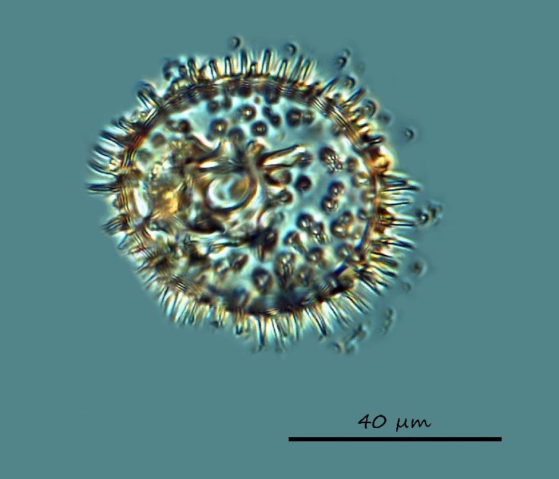 Xanthiopyxis globosa #69357
