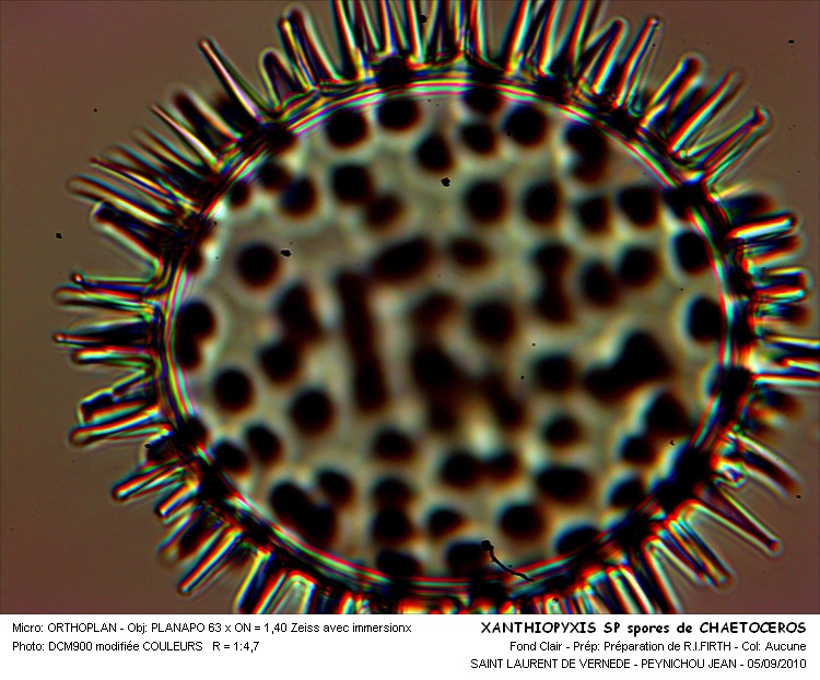 Xanthiopyxis globosa Ehrenberg #18065