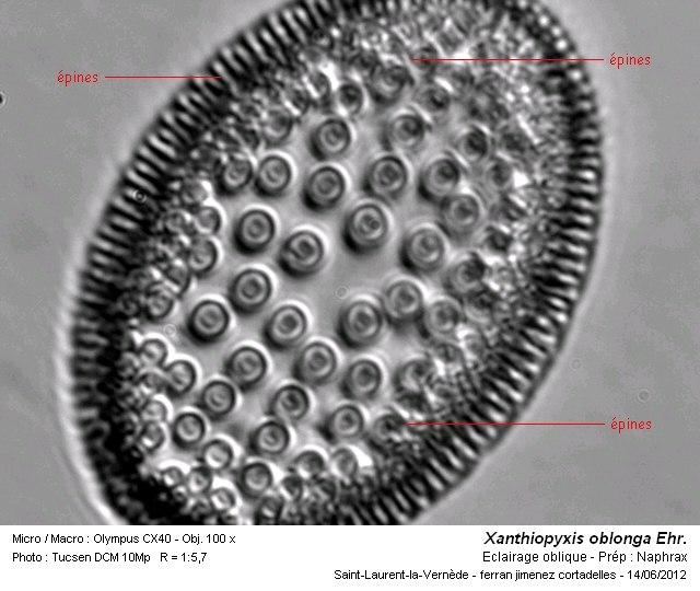Xanthiopyxis oblonga Ehr. #27407