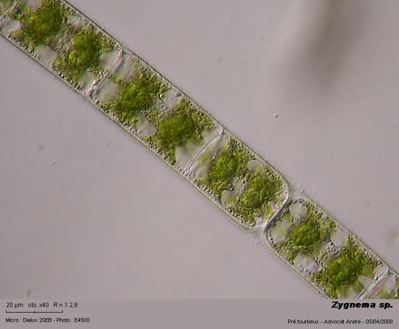 Zygnema sp. #3142