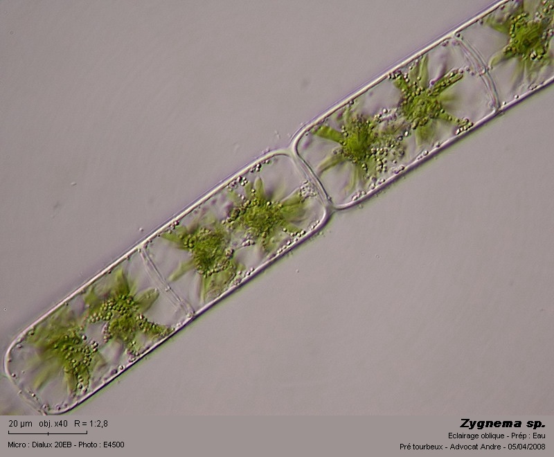 Zygnema sp. #3143